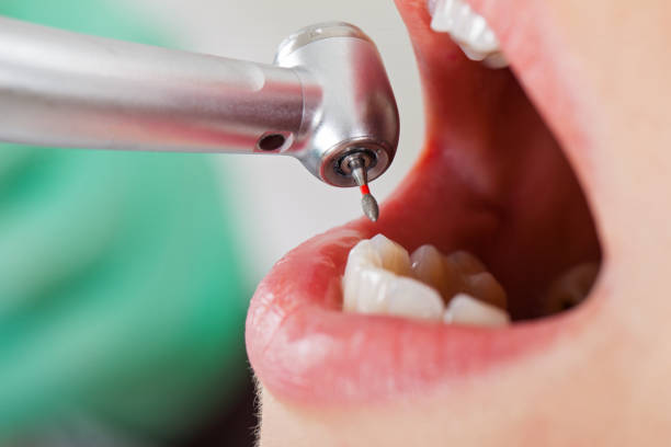Best Urgent Tooth Repair  in Sand Lake, MI